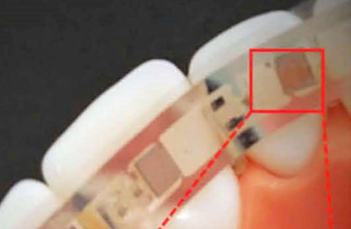 wearable stretchable batteries