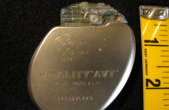 pacemaker battery failure