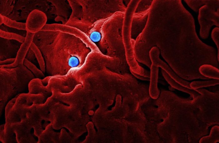 coronavirus epidemic