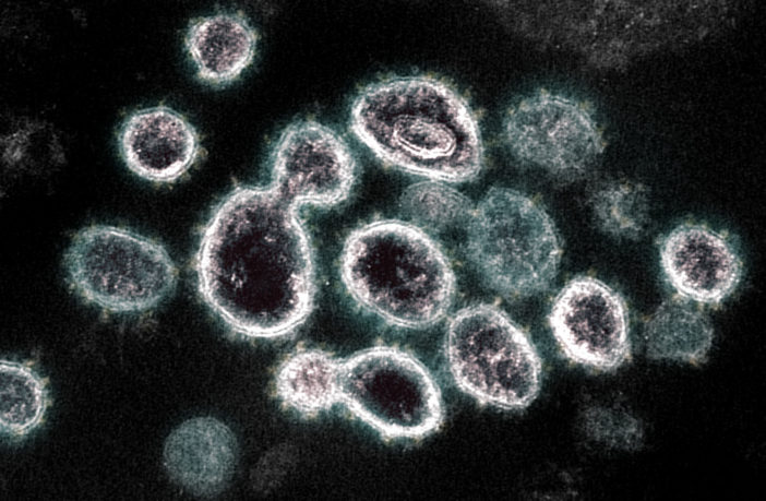 could covid-19 become