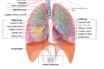 ai predicted respiratory disease developing