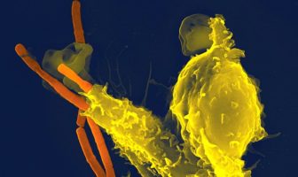 boosting our immune system while sheltering