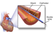 hypertension and covid-19 symptoms