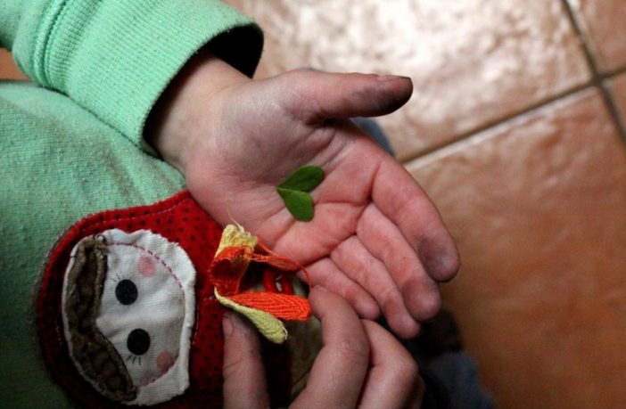 most severe covid-19 symptoms to watch