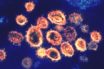 Is muscle pain a good indicator for covid-19