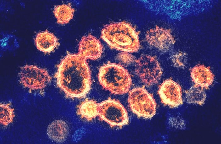 Is muscle pain a good indicator for covid-19