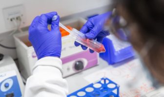 new vaccine test in uk