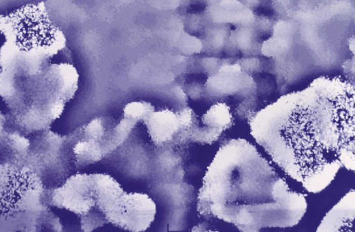 linking covid-19 and gastro infections