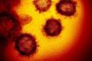 two different varieties of the virus
