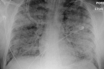 how would we know if we had covid-19