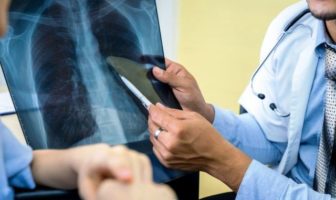 fresh insight into covid-19 lung damage