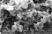 the astra-zeneca blood clots