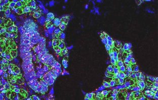 the coronavirus infects the cells of the mouth