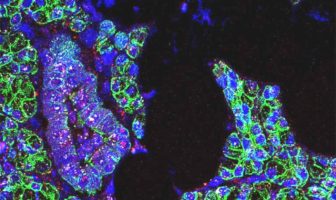 the coronavirus infects the cells of the mouth