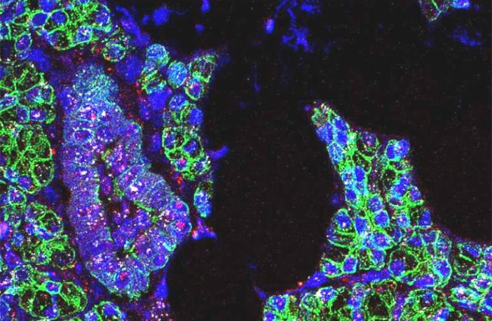 the coronavirus infects the cells of the mouth