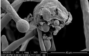 mucormycosis maiming Indian COVID patients