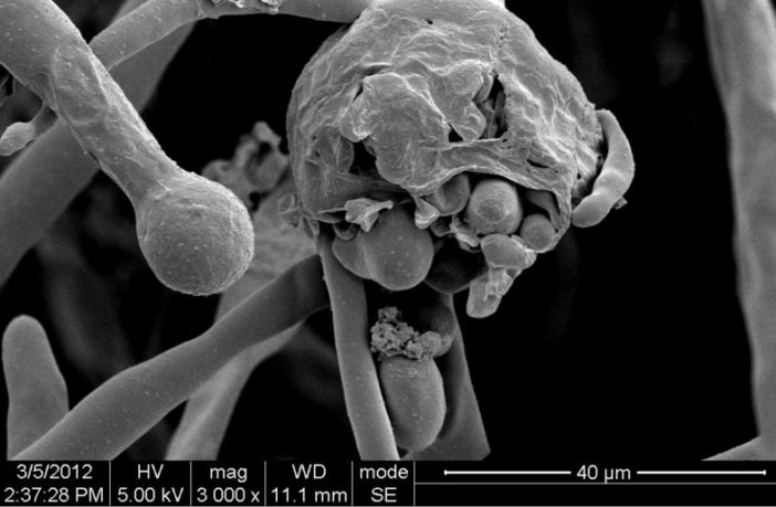 mucormycosis maiming Indian COVID patients
