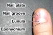 are covid fingernails a sign of antibodies