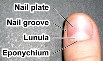 are covid fingernails a sign of antibodies