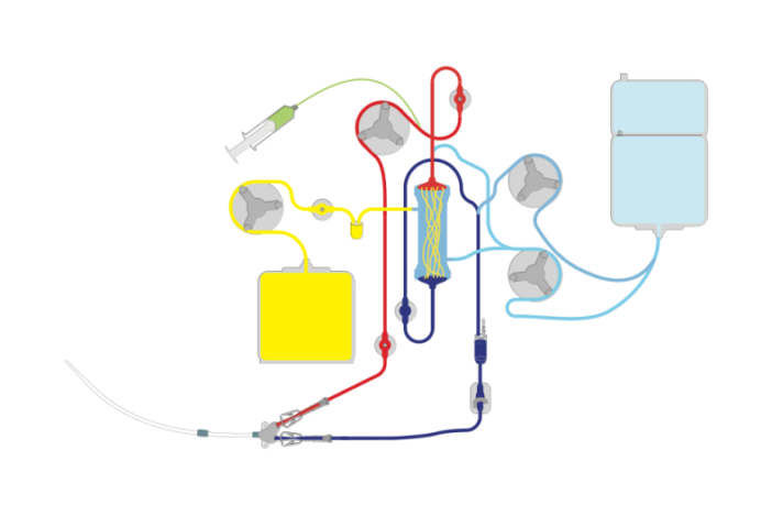 covid risk identified for dialysis patients
