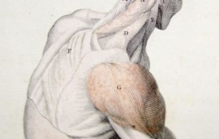 exercising a sore arm after vaccination