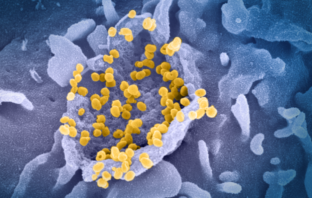 could the covid virus become less lethal