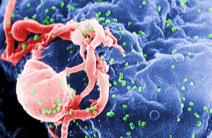 how covid-19 affects people with hiv/aids