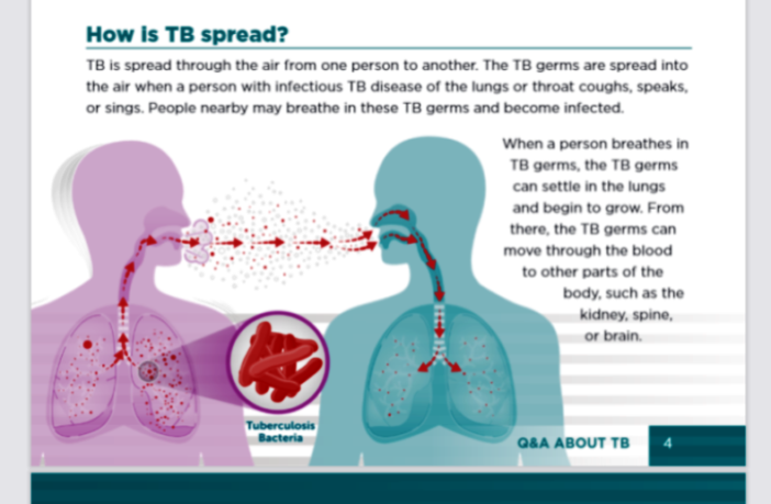 covid and tuberculosis