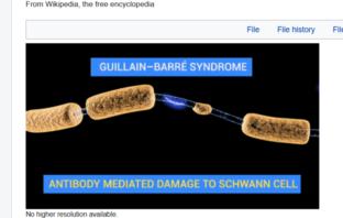 link from covid to guillain-barre syndrome