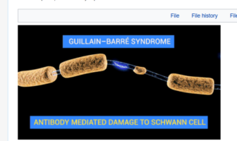 link from covid to guillain-barre syndrome