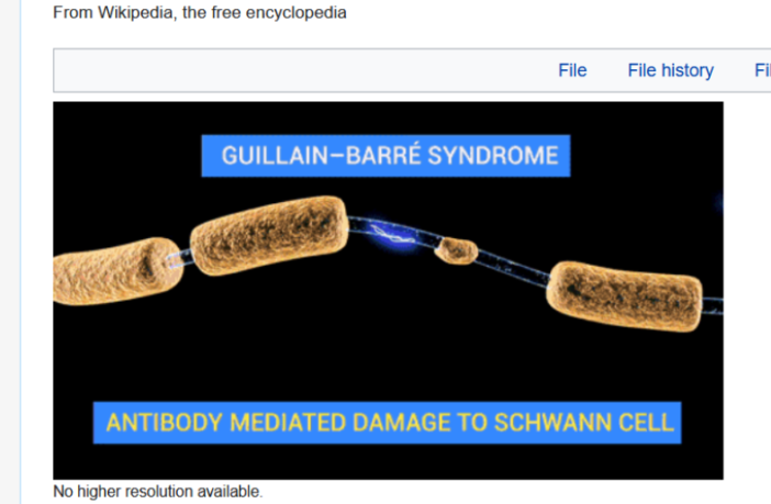 link from covid to guillain-barre syndrome
