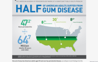 advanced gum disease boosts covid severity