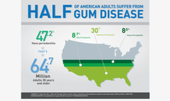 advanced gum disease boosts covid severity