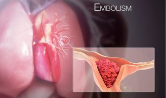 more risk of serious blood clots after covid