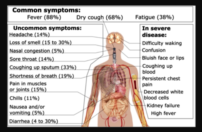 covid-19 secrets we still have to unravel