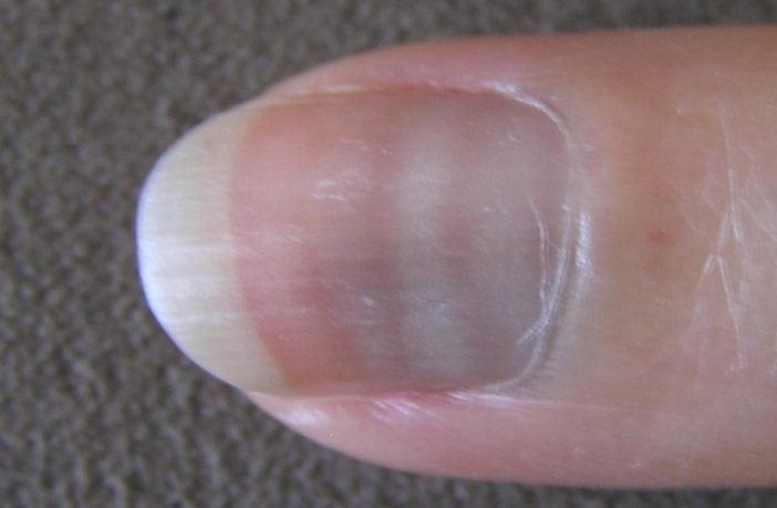 unusual covid-19 symptoms