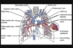 impaired heart function with severe covid-19