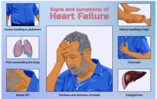 unvaccinated heart patients