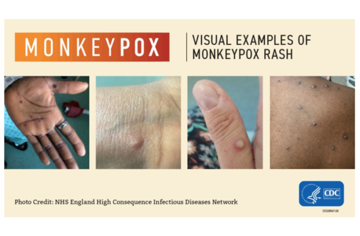 are we doomed to keep repeating history