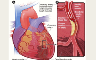 could a viral protein spike your heart