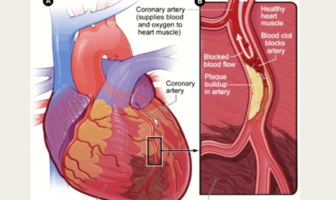 could a viral protein spike your heart