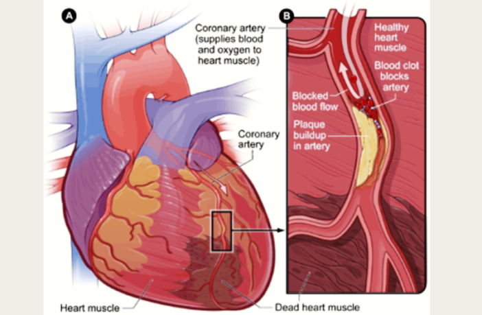could a viral protein spike your heart