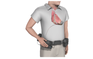 fda class one recall of faulty heart batteries