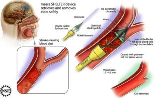 covid and blood clotting link