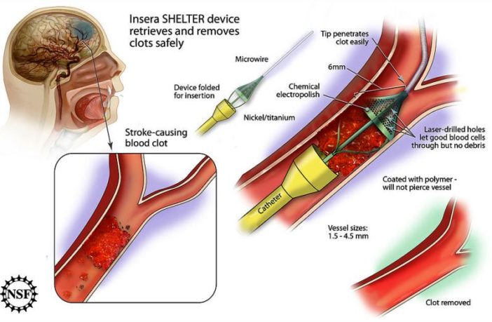 covid and blood clotting link