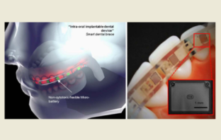 flexible batteries
