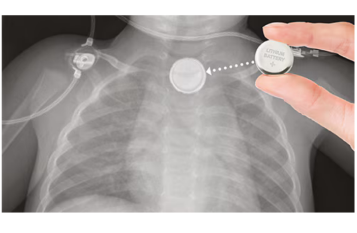 another child another button battery